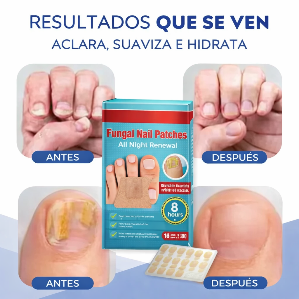 PARCHE UÑAS ANTIHONGOS 2 CAJAS POR EL VALOR DE UNA - ( 16 PARCHES CADA CAJA)